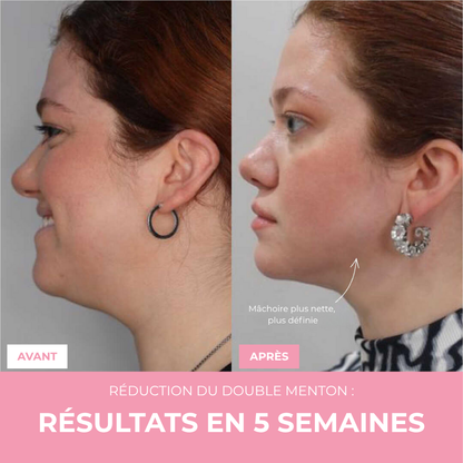 Bandes Buccales Lunava