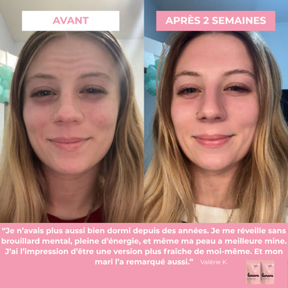 Bandes Buccales Lunava